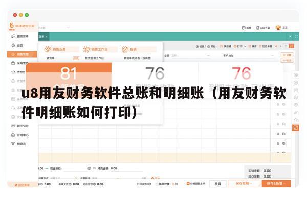 u8用友财务软件总账和明细账（用友财务软件明细账如何打印）